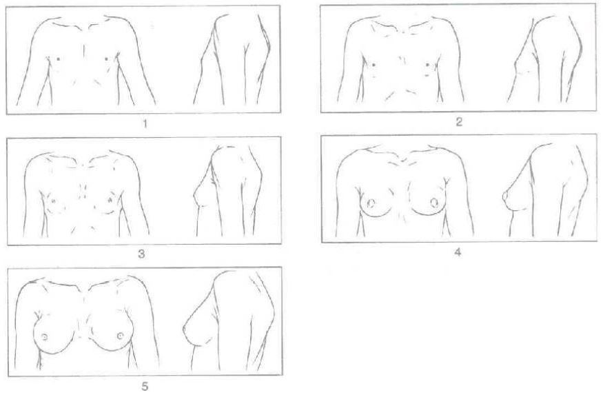 Figure 1 Stades pubertaires du développement mammaire