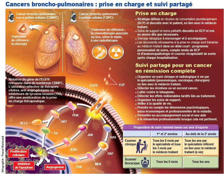 Haute Autorité de Santé - Cancer broncho-pulmonaire : le parcours ...