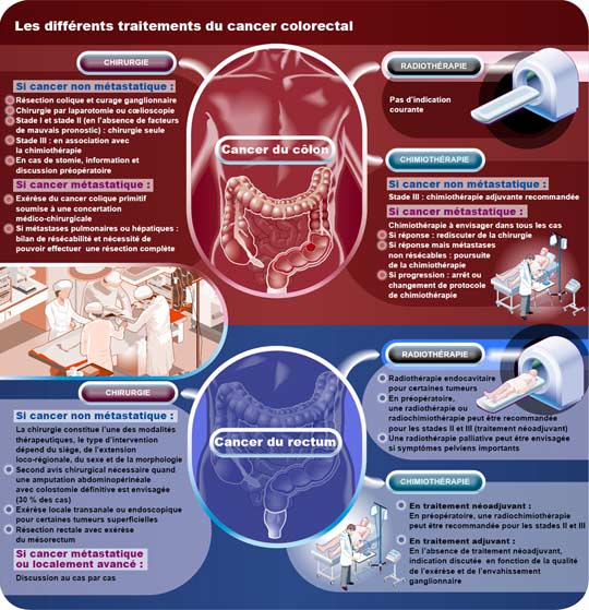 Haute Autorité de Santé - Le cancer colorectal : importance d'une ...