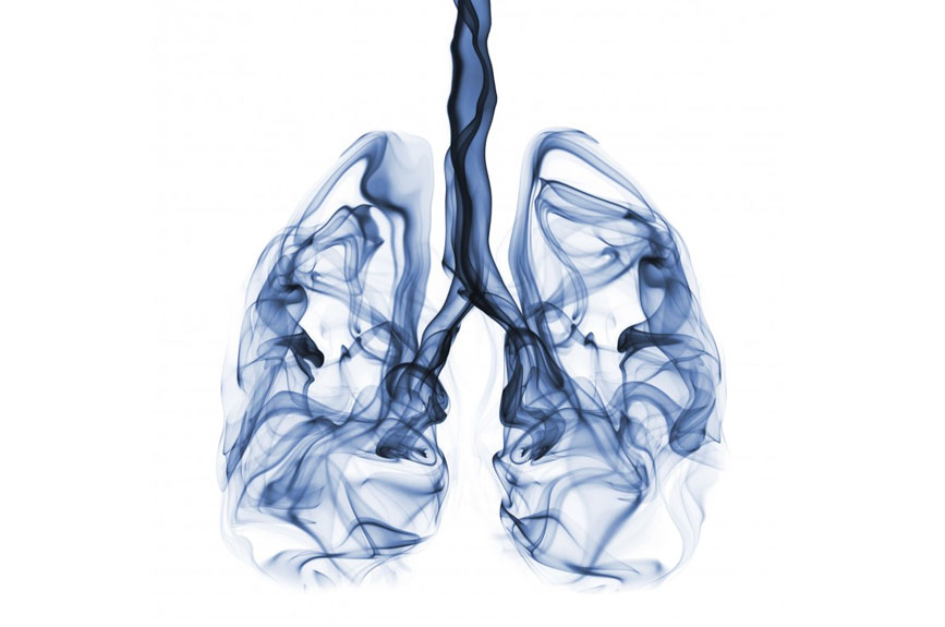 Haute Autorité de Santé Cancer du poumon conditions non réunies — free download