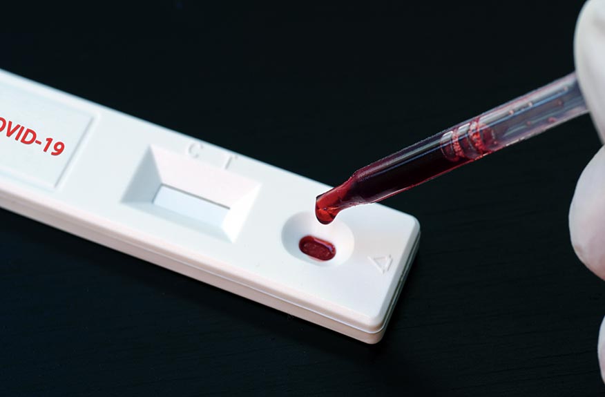 Covid-19 : des TROD pour optimiser l’utilisation des doses de vaccins disponibles