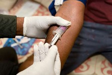image à la une Pertinence du dosage de la chlordéconémie et prise en charge des patients